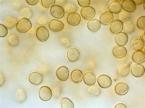  Dictyostelium discoideum - Kun Soluista Syntyy Superorganism!