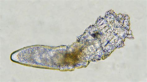  Gregarinea!  Microscopic Parasites Found Lurking Within the Guts of Invertebrates