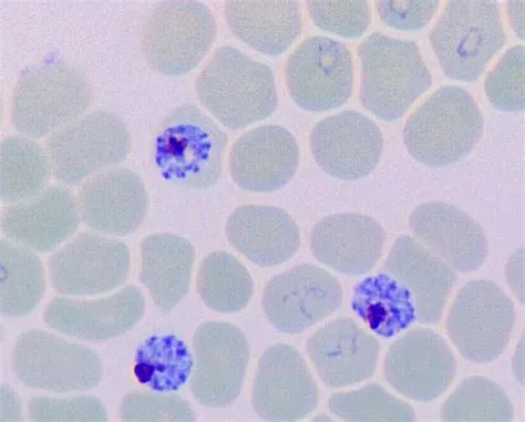  Falciparum Malaria Parasite: A Microscopic Marauder That Steals Our Blood Cells and Hijacks Our Health!