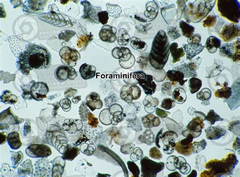  Foraminifera: A Microscopic Marvel That Builds Its Own Exquisite Homes!