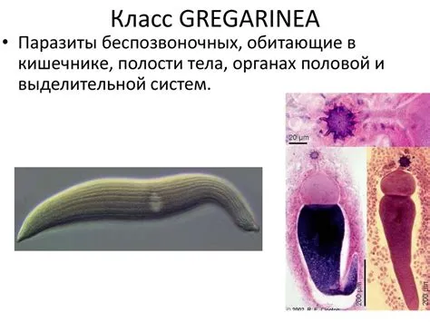 Gregarinea! Löytääksesi uuden suosikkiparasiitin mikroskooppisen maailmansa syövereistä